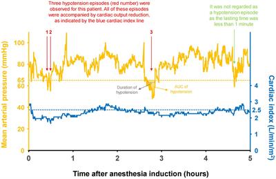 The exploration of perioperative hypotension subtypes: a prospective, single cohort, observational pilot study
